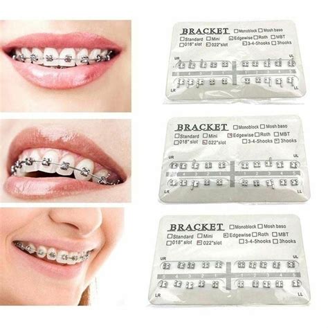 where to buy fake braces online